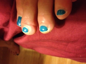 Hard to see, but the circulation of my second toe was cut off because of a hole in my panty hose. Didn't feel a thing. 